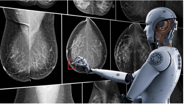 Así funciona la inteligencia artificial que es capaz de detectar más rápido el cáncer de mama